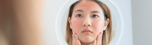 Types of Sensitive Skin
