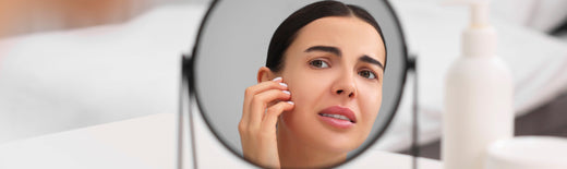 Why Is My Moisturizer Burning My Face All of a Sudden?