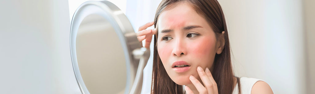 Why Is My Skincare Burning My Face and What Should I Do?
