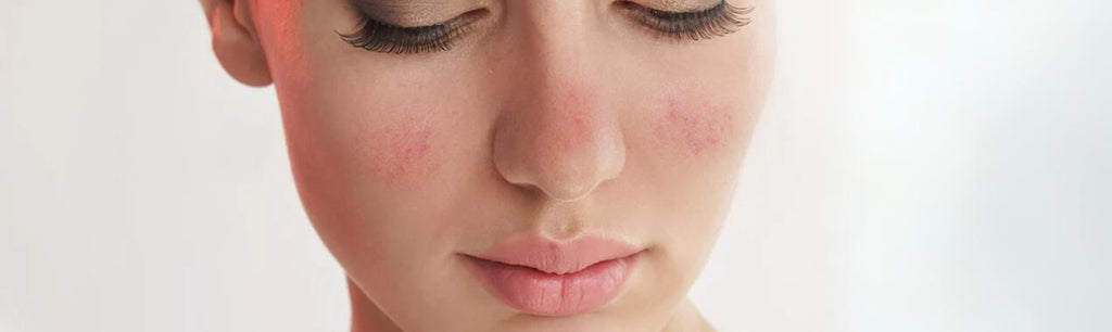 How to Know If You Have Sensitive Skin